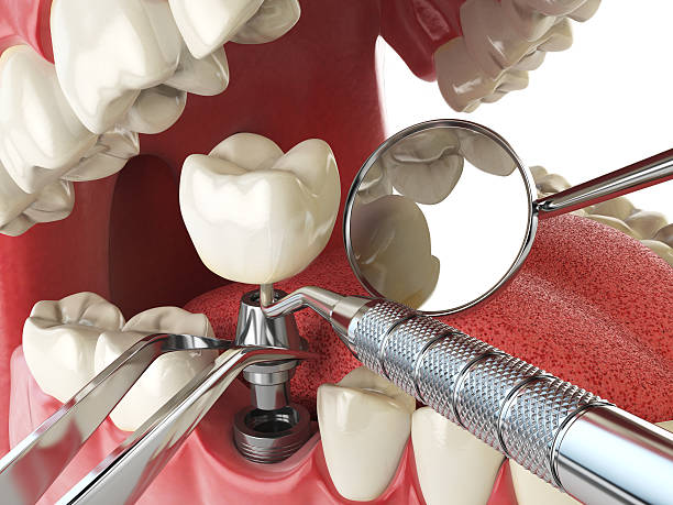 Best Emergency Dentist for Special Needs Patients in Statesville, NC