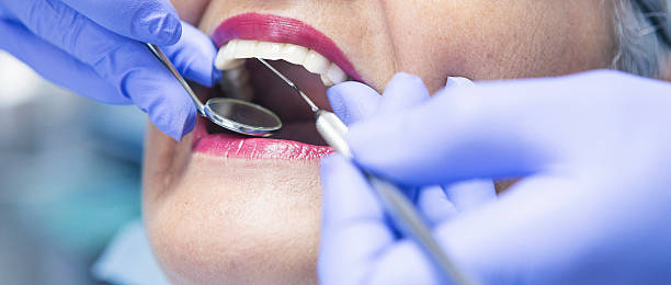 Best Broken or Cracked Tooth Emergency Dentist in Statesville, NC
